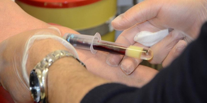 Sinsi hastalık: Hepatit B