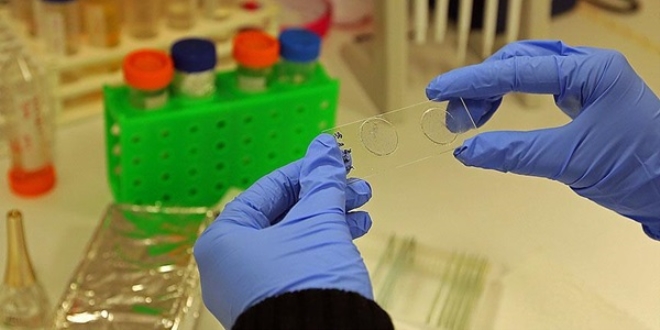 Genetiği değiştirilmiş larvalar iyileşmeyen yaralara çare oldu