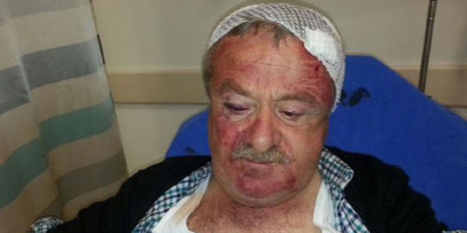 MHP'li meclis üyesine tekme tokatlı saldırı
