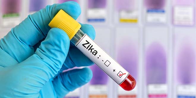 Zika virüsüyle mikrosefali bağlantısı saptandı