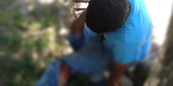Parkta oynayan çocuk, köpeğin saldırısına uğradı