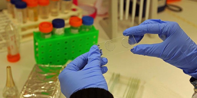 Bilim adamları Zika virüsünü klonladı