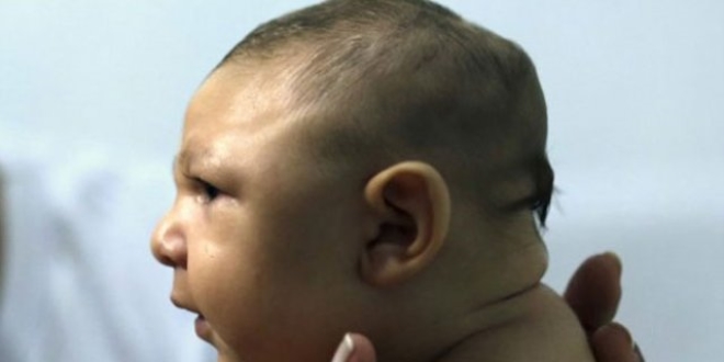 Zika virüsü bu yaz Avrupa'ya ulaşabilir