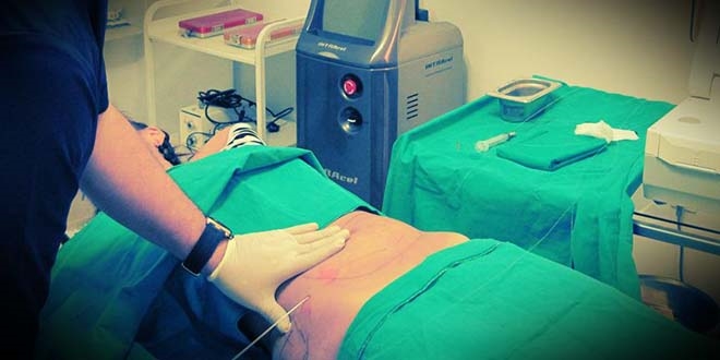 Karın yağlarını aldırdıktan sonra ölen kadın için tazminat
