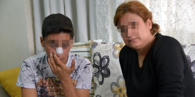 Kızıyla sohbet eden ortaokul öğrencisinin burnunu kırdı