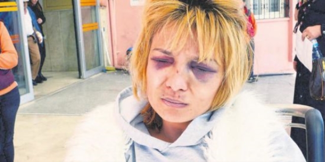 'Bulaşık' yüzünden eşini darbeden şahıs tutuklandı