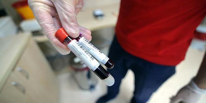 Kan testiyle kalp krizi riski tespit edilebiliyor