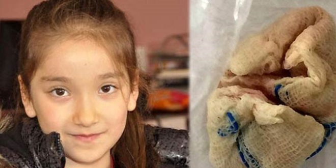 Bademcik ameliyatı olan kızın boğazında gazlı bez unutuldu