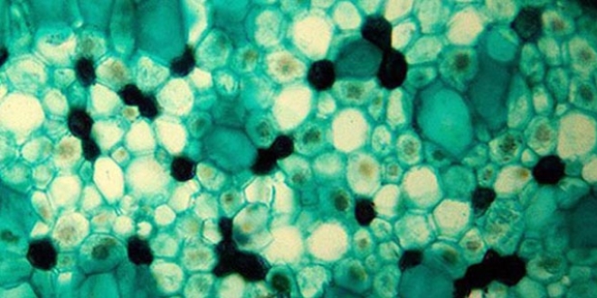 Yaşlanmayla ilgili protein keşfedildi