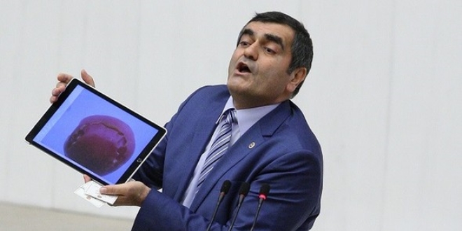 CHP'li Şeker: O vekil ısırılmadı, yarası eski