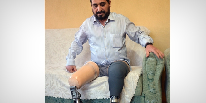 Sigaradan bacaklarını kaybeden baba oğluna bıraktırmaya çalışıyor