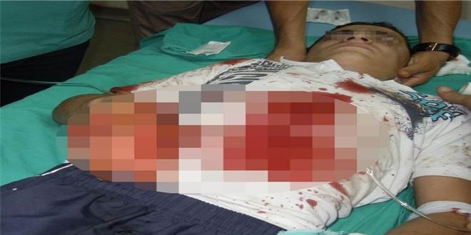 Hatay'da elindeki fünye patlayan astsubay yaralandı