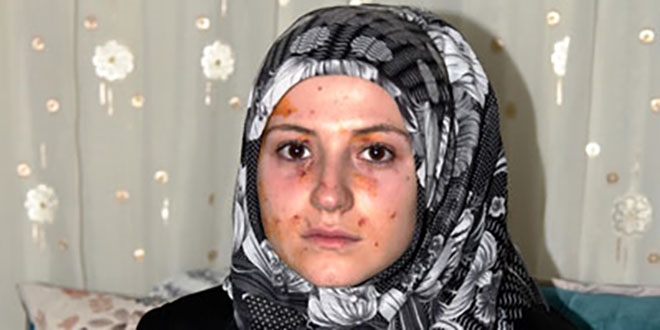 Kız öğrencilerin kavgası karakolda bitti