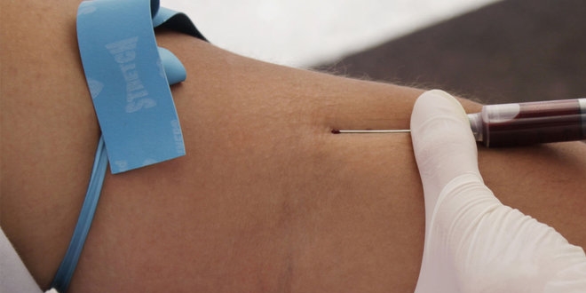 AYM'den AIDS'li işçiye gizlilik tazminatı