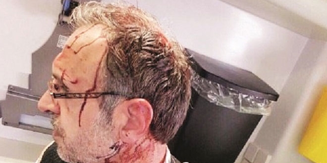 Referandumu gölgelemeye çalışan PKK'lılar Hollanda'da yine sahnede