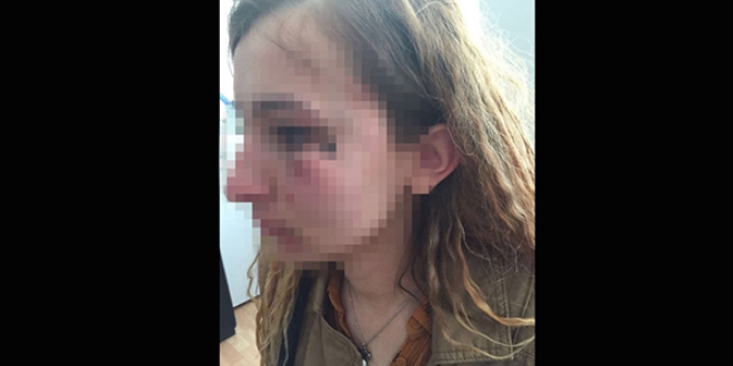Başkanın yanında kadın polisi darp etti