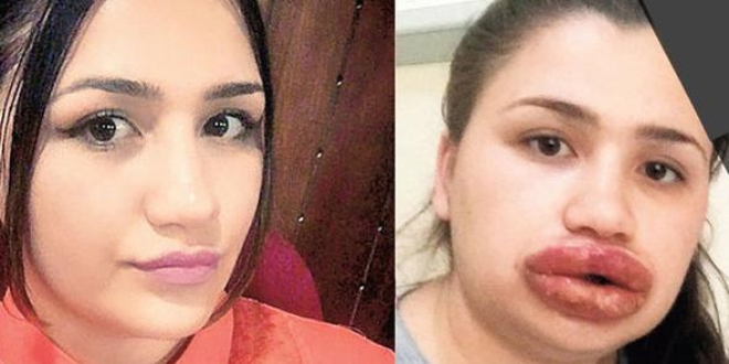 Güzellik uğruna Merve hemşirenin başına gelenler