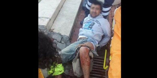 Polise bıçak çeken hırsız vuruldu
