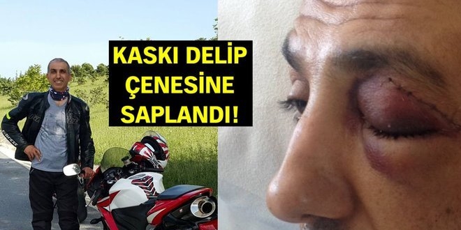 Yorgun mermi kaskı deldi