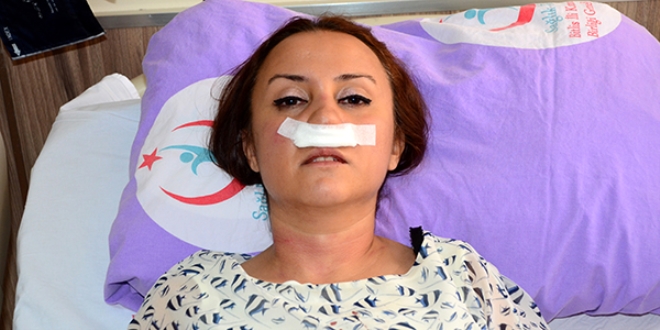 Dokturun burnunu kırdı... Gözaltında