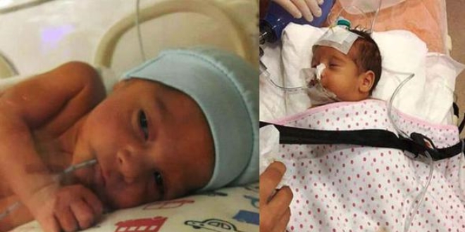 Aras Kuzey bebek yaşama 57 gün tutunabildi