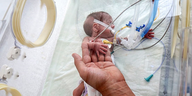 'Mucize bebek' ameliyatla yaşama tutundu