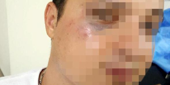 112 ekibine saldıran 3 şüpheli gözaltına alındı