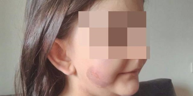 5 yaşındaki çocuğa işkenceye tutuklama