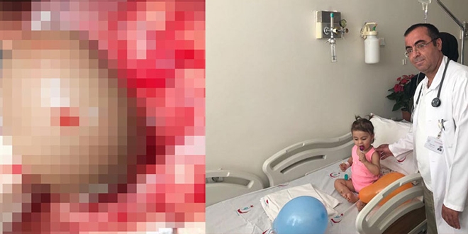 1.5 yaşındaki Mihriban'ın karnından 10 cm'lik kist çıktı
