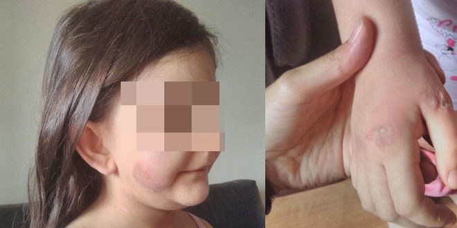 Eşinden işkence gören kadın ve 5 çocuğuna koruma