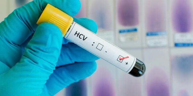 'Hepatit C artık çok etkili tedavi edilebiliyor'