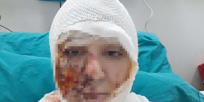 Savcı itiraz etti, kezzaplı saldırgan gözaltına alındı