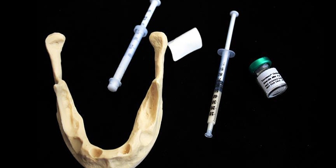 'Türkiye'de yılda 400 bin implant yapılıyor'