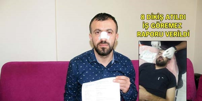 Hasta yakını erkek hemşirenin burnunu kırdı