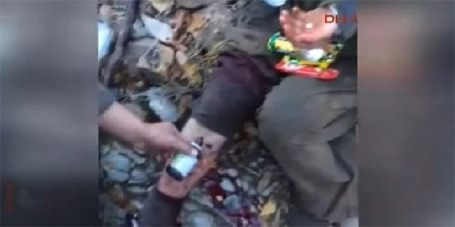 Mehmetçik yaralı teröristi böyle tedavi etti