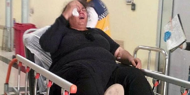 Yeğeninin yurda verilmesine karşı çıkınca hastanelik etti!