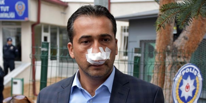 Hesaba itiraz eden müşteriye dayak
