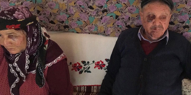 Yaşlı çifti bayıltana kadar dövüp, gasp ettiler