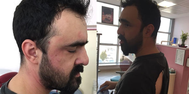 Hem randevusuna geç kaldı, hem doktoru darp etti
