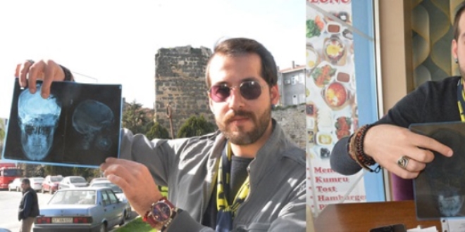 Ağzında çıkması gereken diş, beyninde çıktı