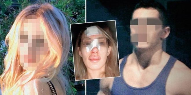 Mahkeme burun kıran eski sevgiliyi serbest bıraktı