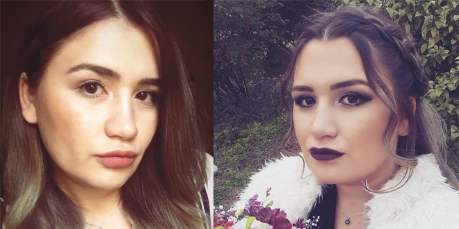 Silikon mağduru Merve hemşire eski haline döndü