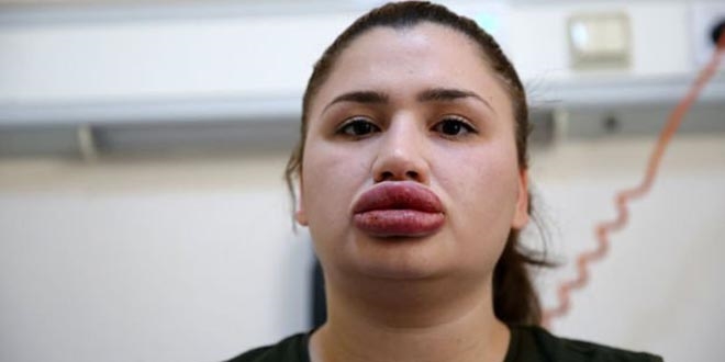 Merve Hemşirenin doktoru'ndan estetik açıklaması