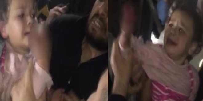 Asansör kapısına eli sıkışan çocuğun iki parmağı koptu