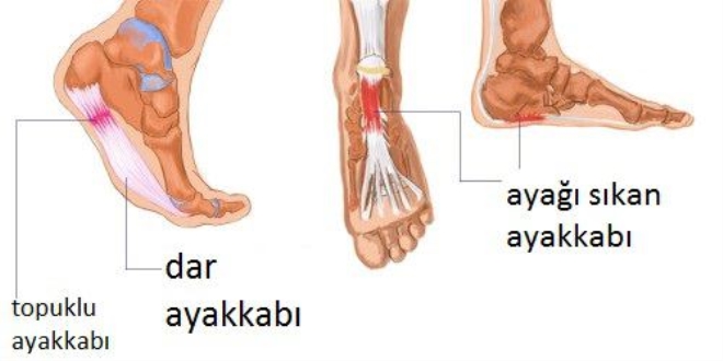Doğru ayakkabı seçimini dikkat