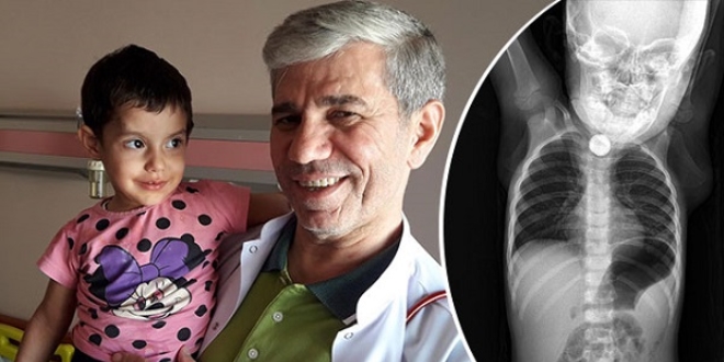 1,5 yaşındaki Berfin'in yuttuğu pil operasyonla alındı