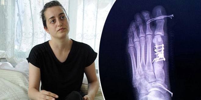 Sağlam parmağa ameliyat iddiasına, doktordan suç duyurusu