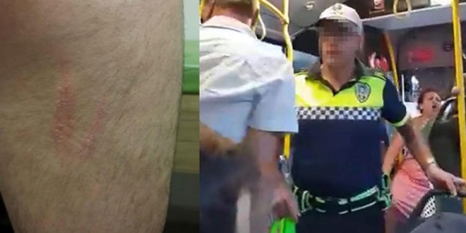Polis, kendisine saldıran köpeğe ateş etti