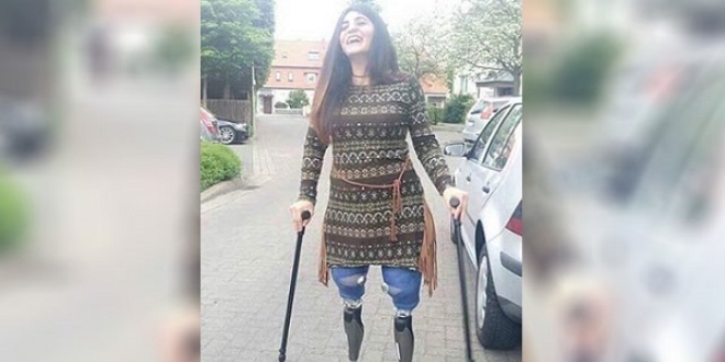 Mitingde iki bacağını birden kaybetmişti... İdare mahkemesi kararını verdi