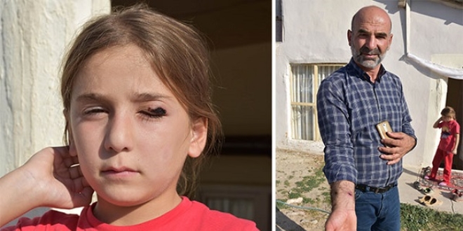 Sivas'ta 'şarbon' paniği! Köy karantinaya alındı